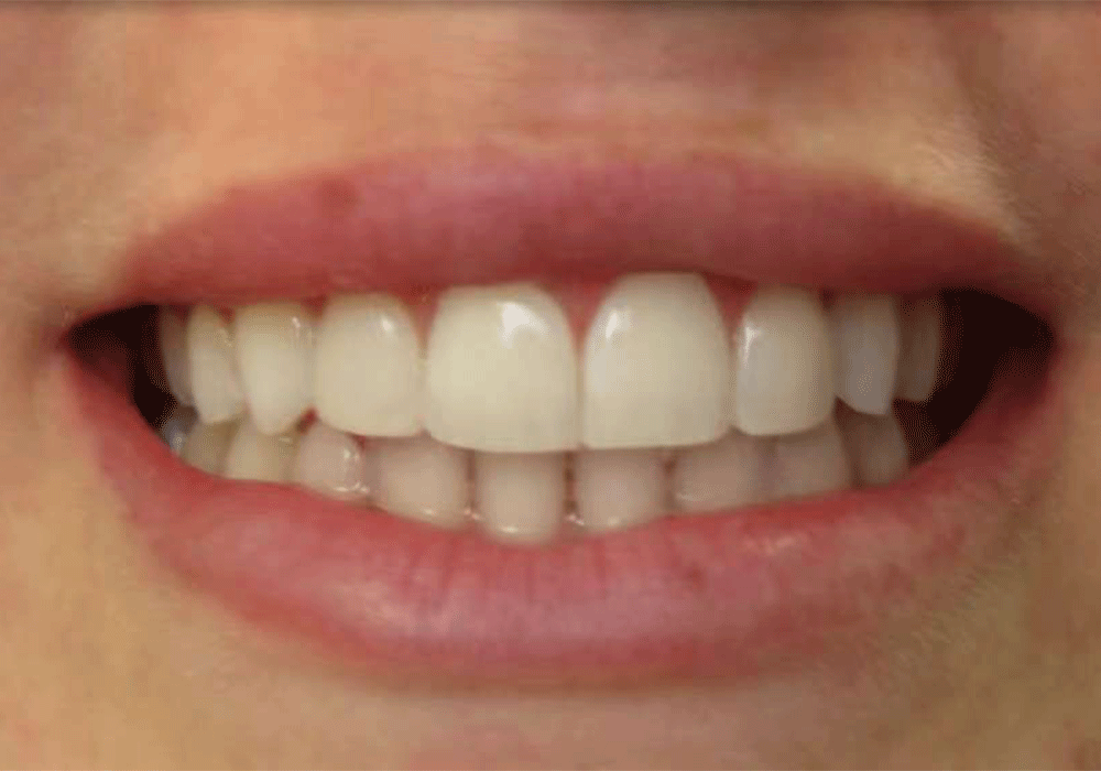restorative dentistry - wow dental