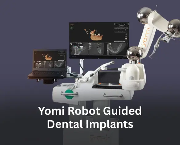 Yomi-Robot-Guided-Dental-Implants